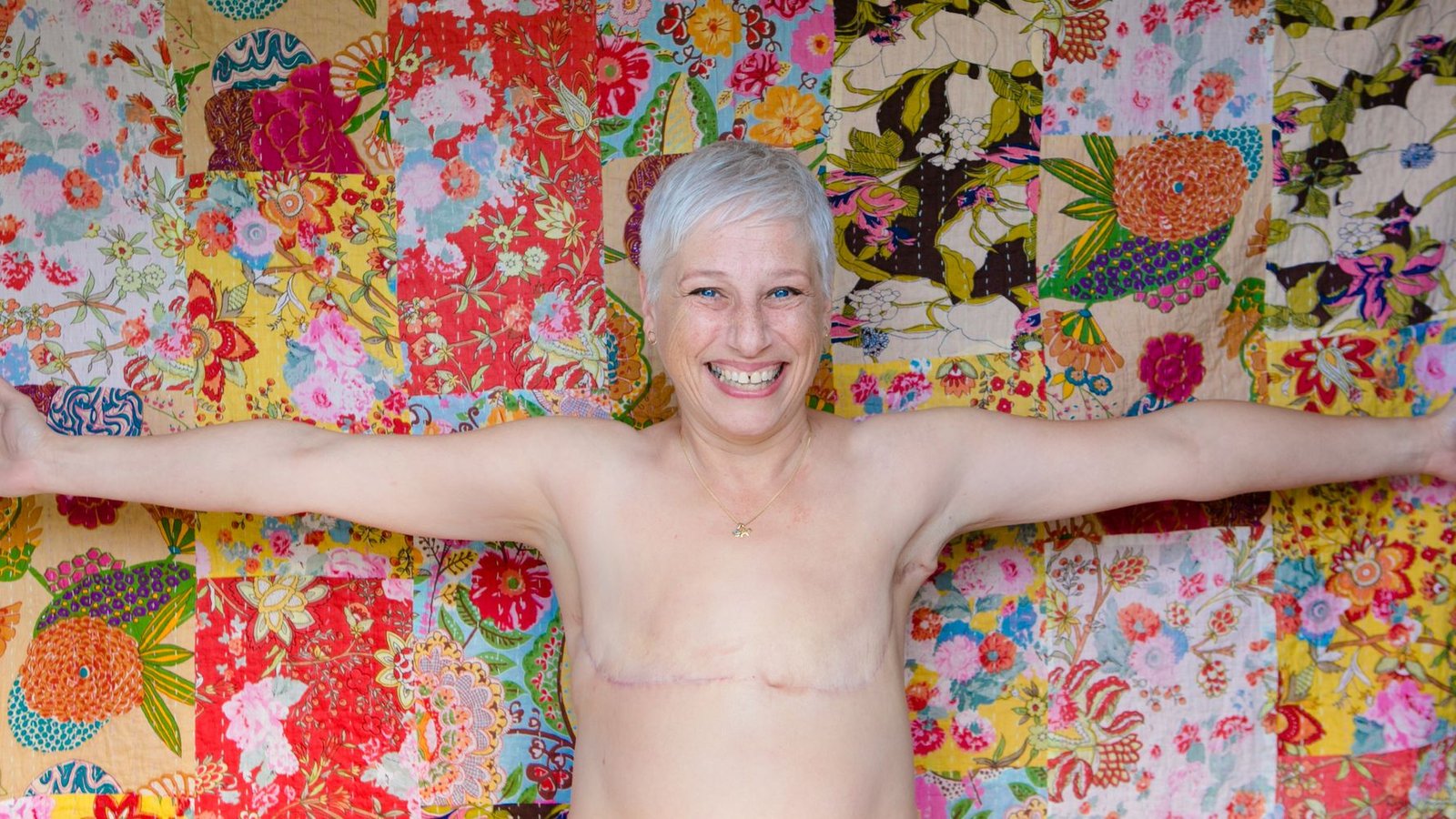 A mastectomy is surgery to remove a breast. It is part of treatment for breast cancer. Here's what you need to know about this procedure.