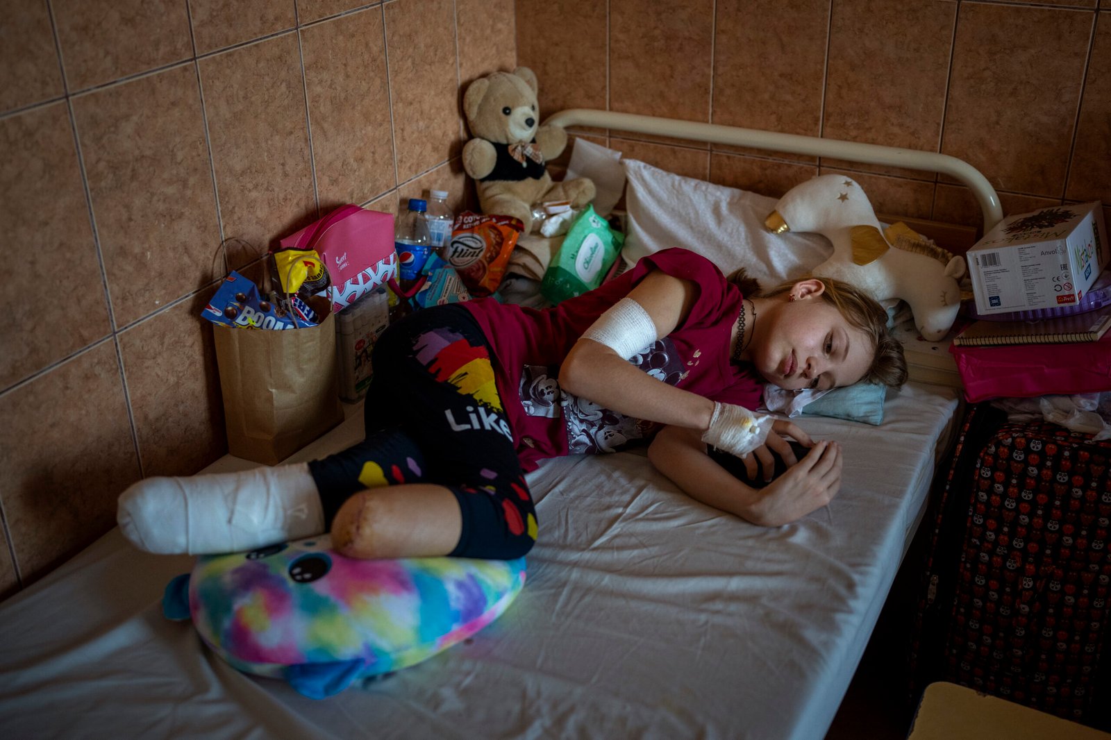 In photo shows bomb casualty amputations, like in Ukraine, where Yana Stepanenko lost both legs.