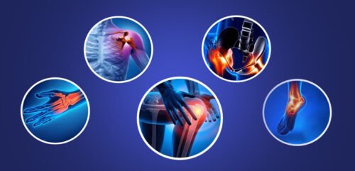 Orthopedic devices
