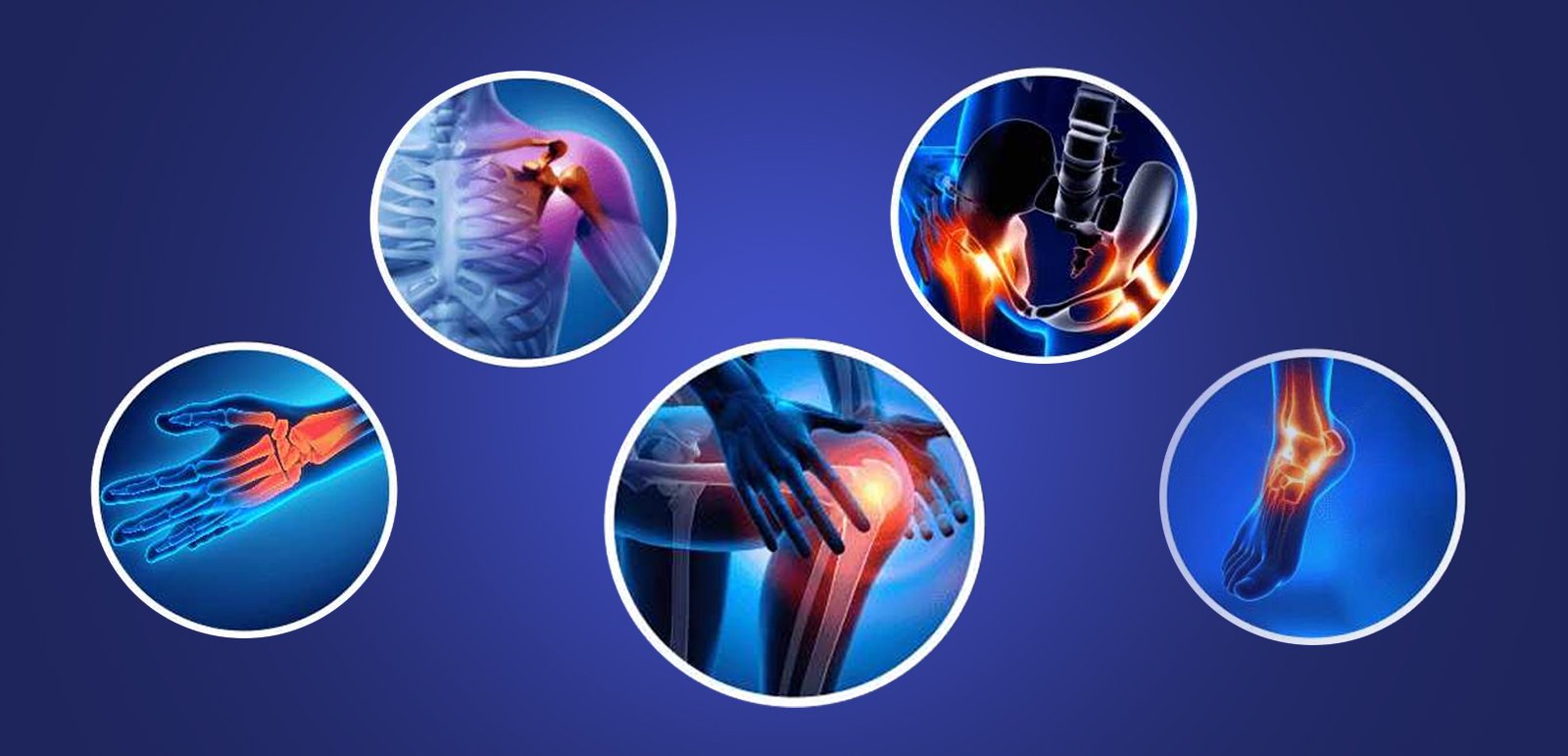 An orthopedic device designed to replace a joint, bone, or cartilage due to damage or deformity.