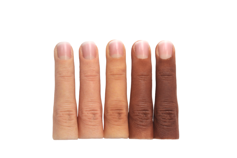 Prótesis De Dedos Para Hombre