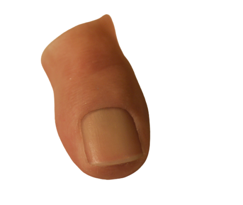 Prótesis Para El Dedo Gordo Del Pie
