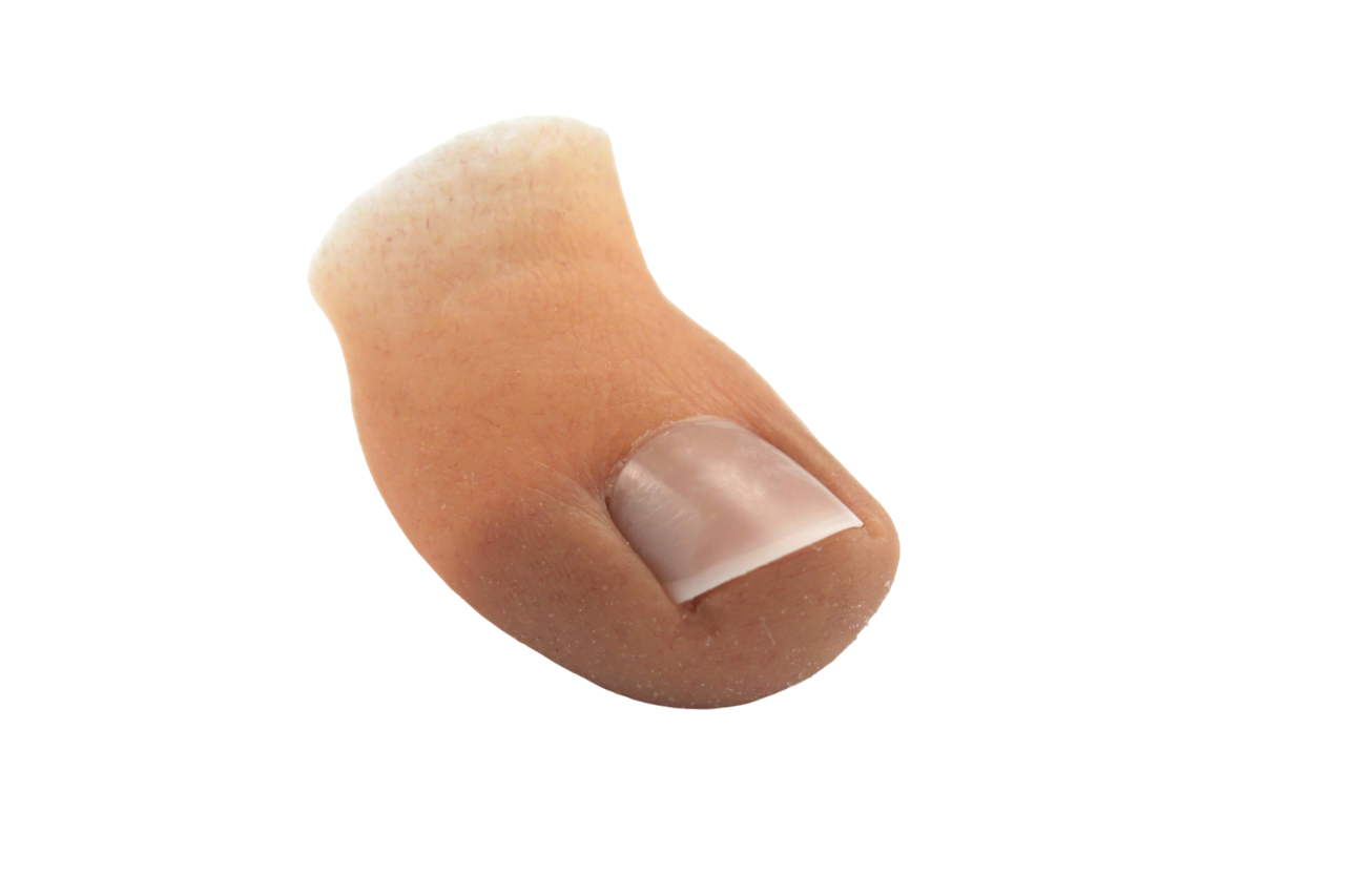 Prótesis dedo gordo del pie - falange distal - Prótesis para el Dedo Gordo del pie