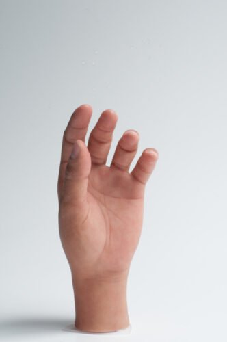Epítesis De Silicona Para La Mano